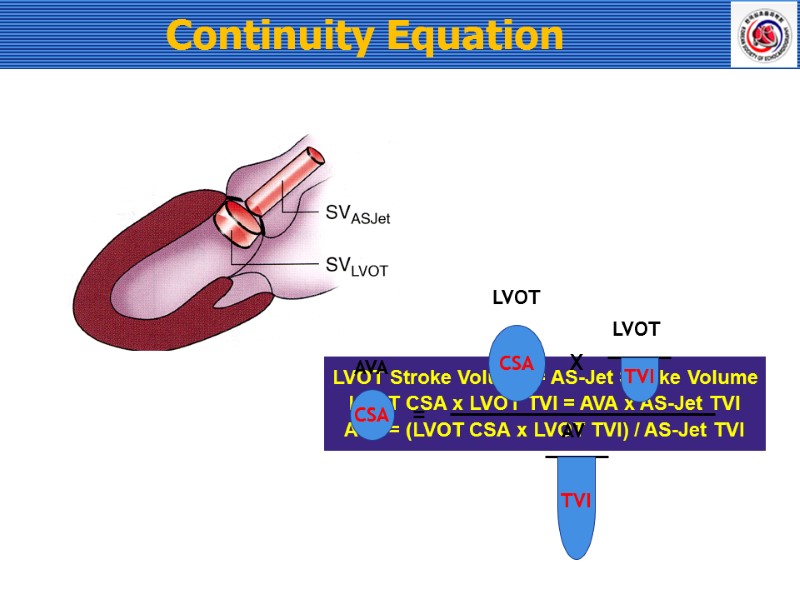 Continuity Equation   LVOT Stroke Volume = AS-Jet Stroke Volume LVOT CSA x